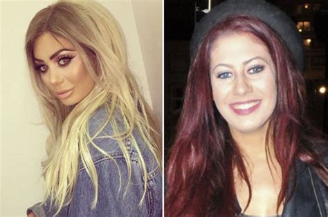 chloe ferry before|chloe ferry before surgery.